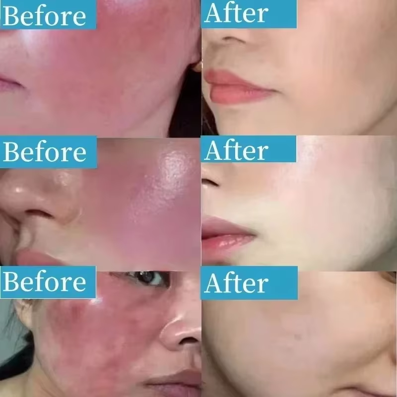 Koreański krem na zaczerwienie – Coenzyme Q10 Cream recenzja i cena