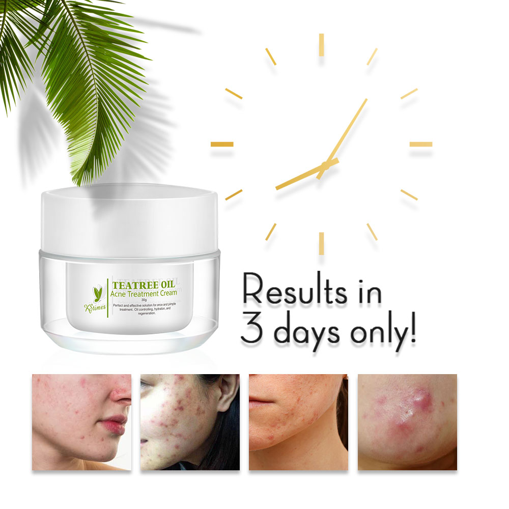 KStims Natural Acne Treatment  – Tea Tree Spot Treatment recenzja i cena